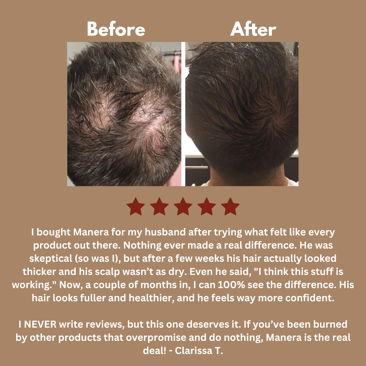 MANERA® 4-IN-1 NATURAL ROOT ACTIVATOR OIL